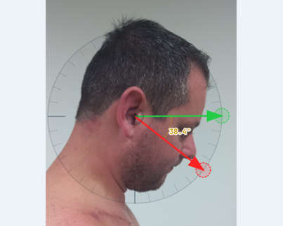Goniometria digital interativa — cervical