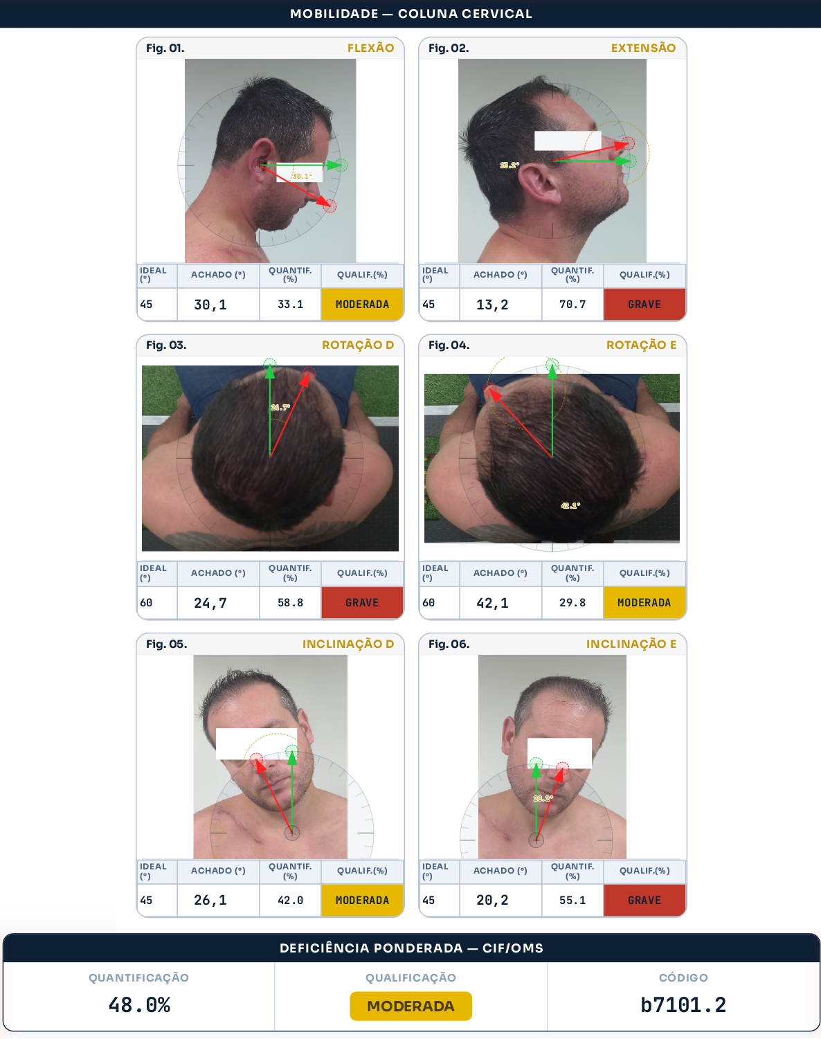 Parecer de mobilidade articular cervical